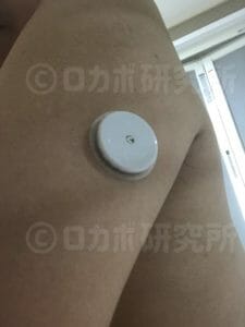 フリースタイルリブレを腕の裏に貼り付ける